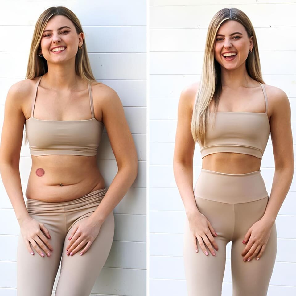 GFOUK WEIGHT LOSS PATCHES image